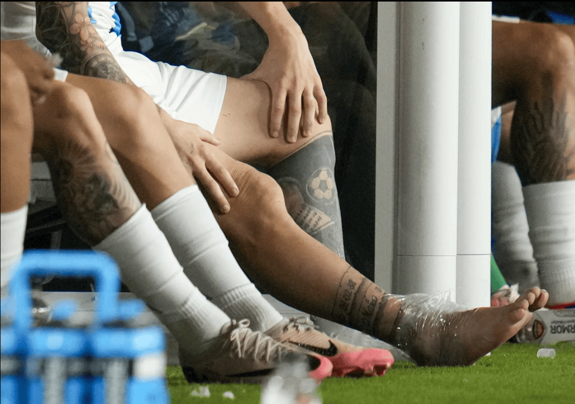 包含阿根廷球星梅西再度受伤，将缺席大赛的词条